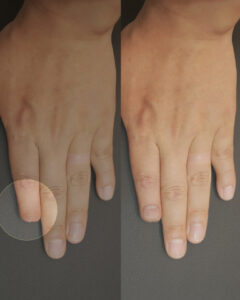 산업재해 예방을 위한 그린손가락 캠페인