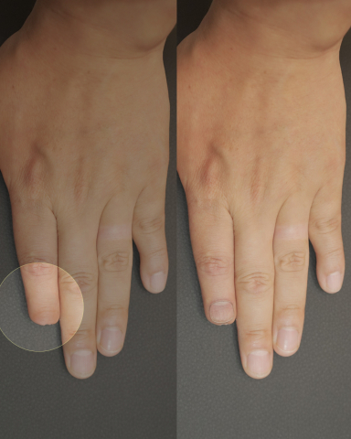 You are currently viewing 산업재해 예방을 위한 그린손가락 캠페인